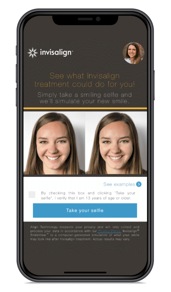 Invisalign® 3 2021 07 27